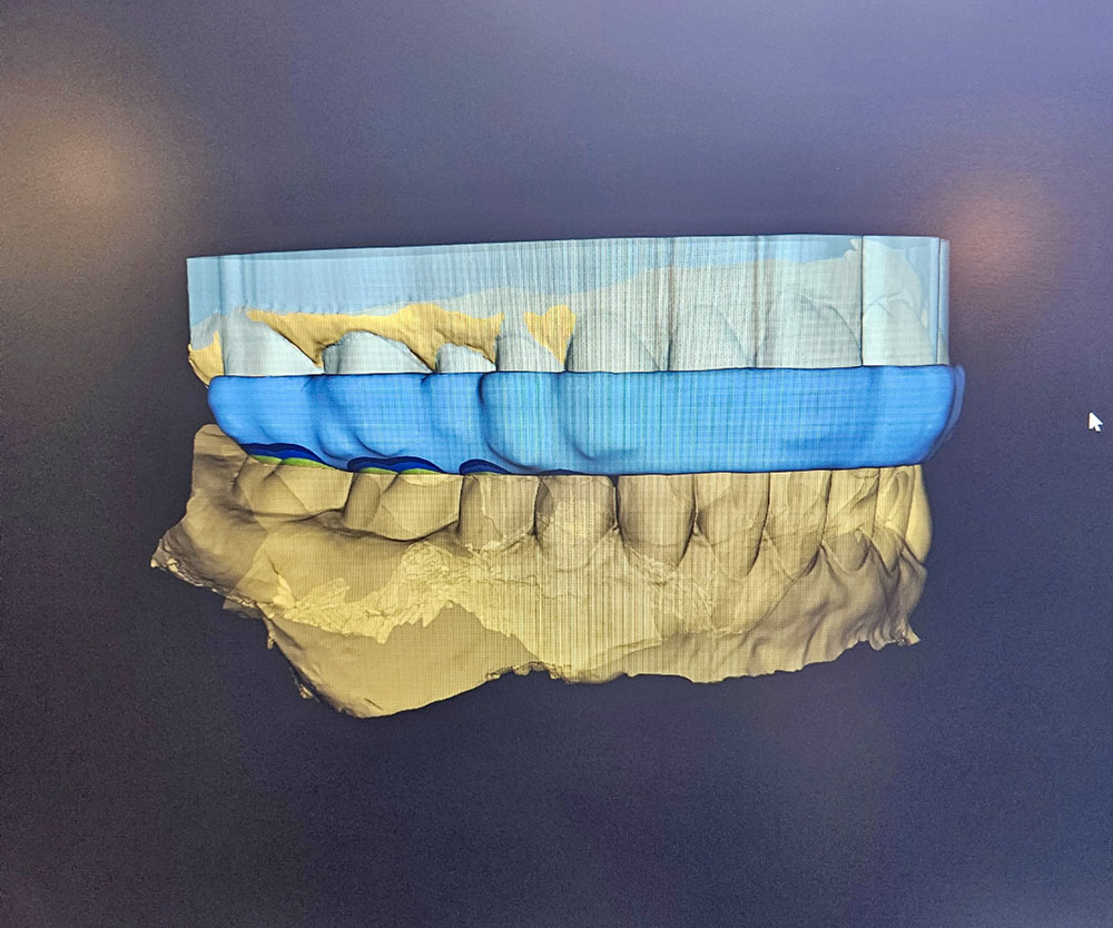 Our Technology. Dentist in Midwest City, OK. Dr. Melanie Emerson, Dr. Meredith Turbeville. Melanie Emerson DDS