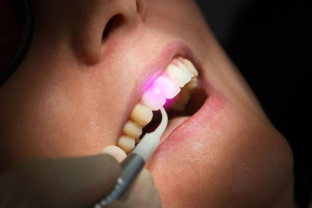 Our Technology. Dentist in Midwest City, OK. Dr. Melanie Emerson, Dr. Meredith Turbeville. Melanie Emerson DDS